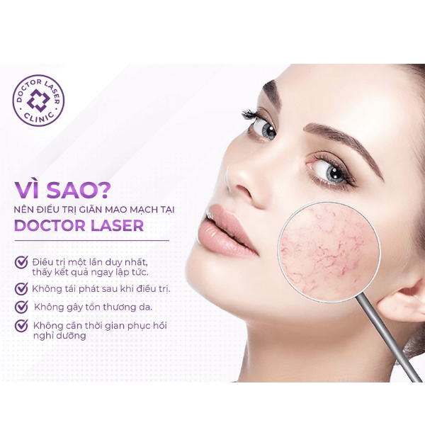 Vì sao nên điều trị giãn mao mạch ở Doctor Laser?